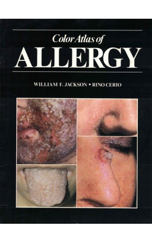 Color Atlas of Allergy | de William F. Jackson e Rino Cerio