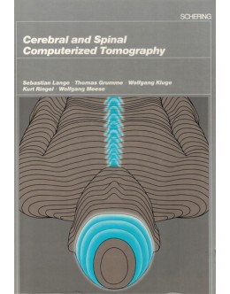 Cerebral and Spinal Computerized Tomography | de Vários Autores