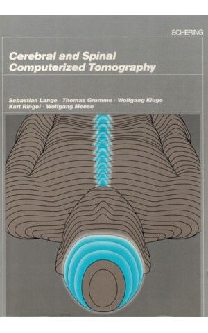 Cerebral and Spinal Computerized Tomography | de Vários Autores