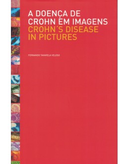 A Doença de Crohn em Imagens / Crohn's Disease in Pictures | de Fernando Tavarela Veloso