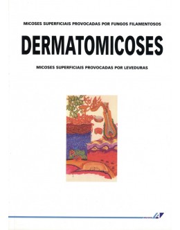 Dermatomicoses | de Luís Carlos Costa e João David Miranda