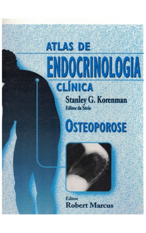 Atlas de Endocrinologia Clínica - Osteoporose | de Stanley G. Korenman e Robert Marcus