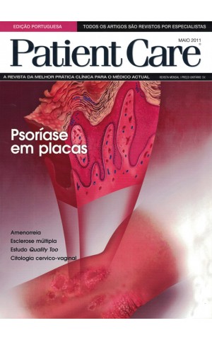 Patient Care - Vol. 16 - N.º 170 - Maio 2011