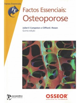 Factos Essenciais: Osteoporose | de Juliet E. Compston e Clifford J. Rosen