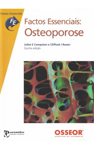 Factos Essenciais: Osteoporose | de Juliet E. Compston e Clifford J. Rosen