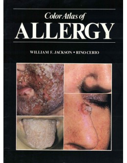 Color Atlas of Allergy | de William F. Jackson e Rino Cerio